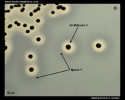 staphylococcus aureus on baird parker agar, positive lecithinase and lipase